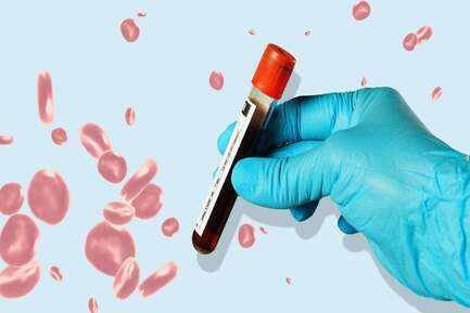 What blood tests detect fertility?